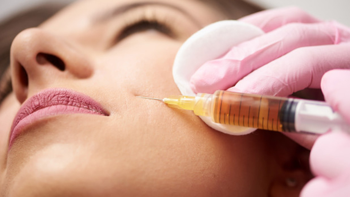 Correct the appearance of Marionette Lines , folds, lines and wrinkles